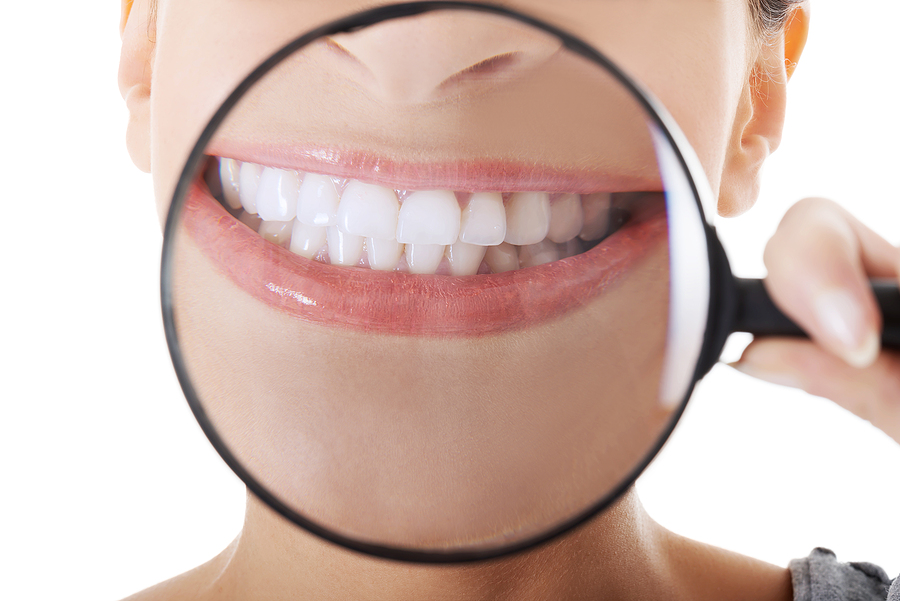 Are Veneers Worth the Investment? Here’s What You’re Really Paying For